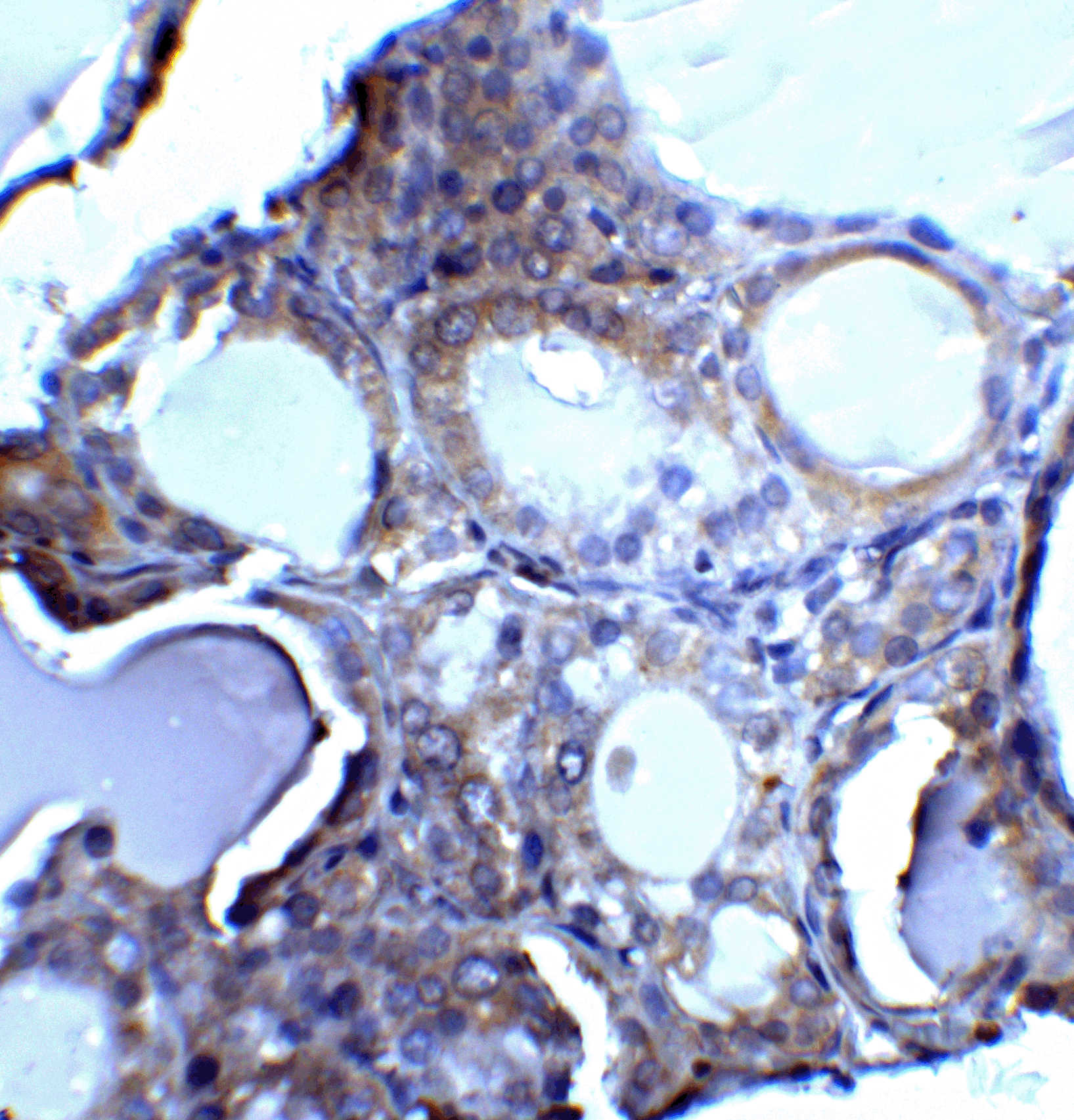 DNase II Antibody