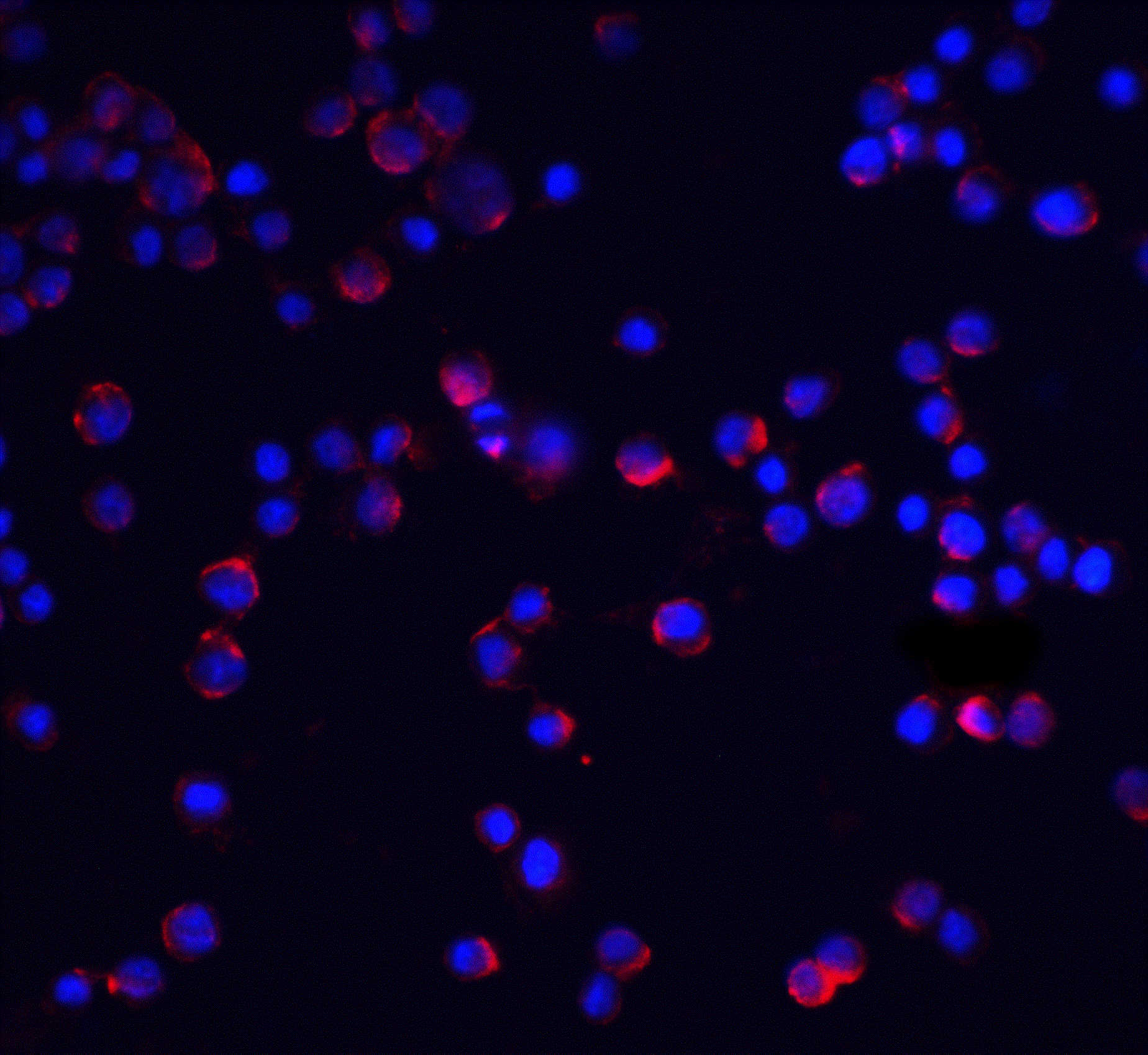 IL-1RAcP Antibody