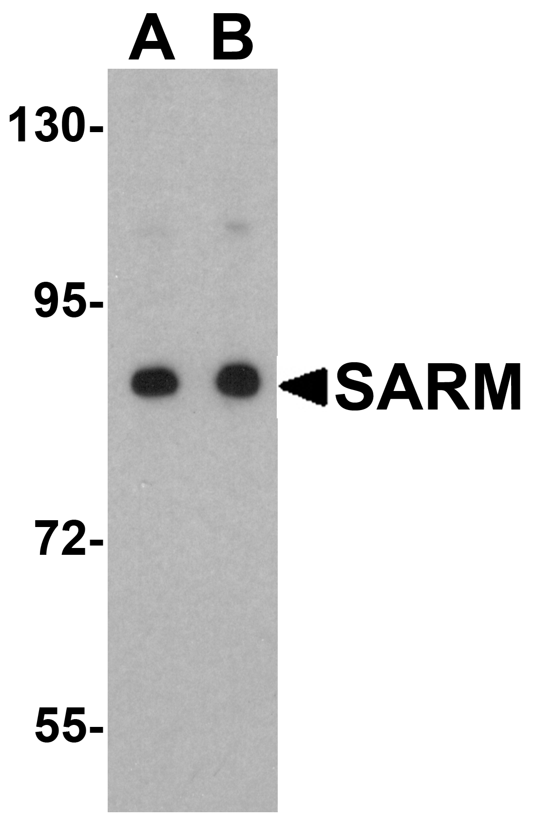 SARM Antibody