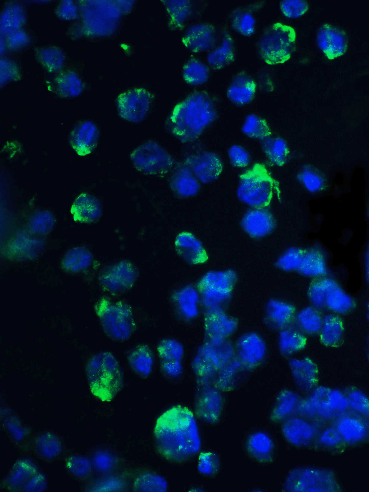 4E-BP1 Antibody