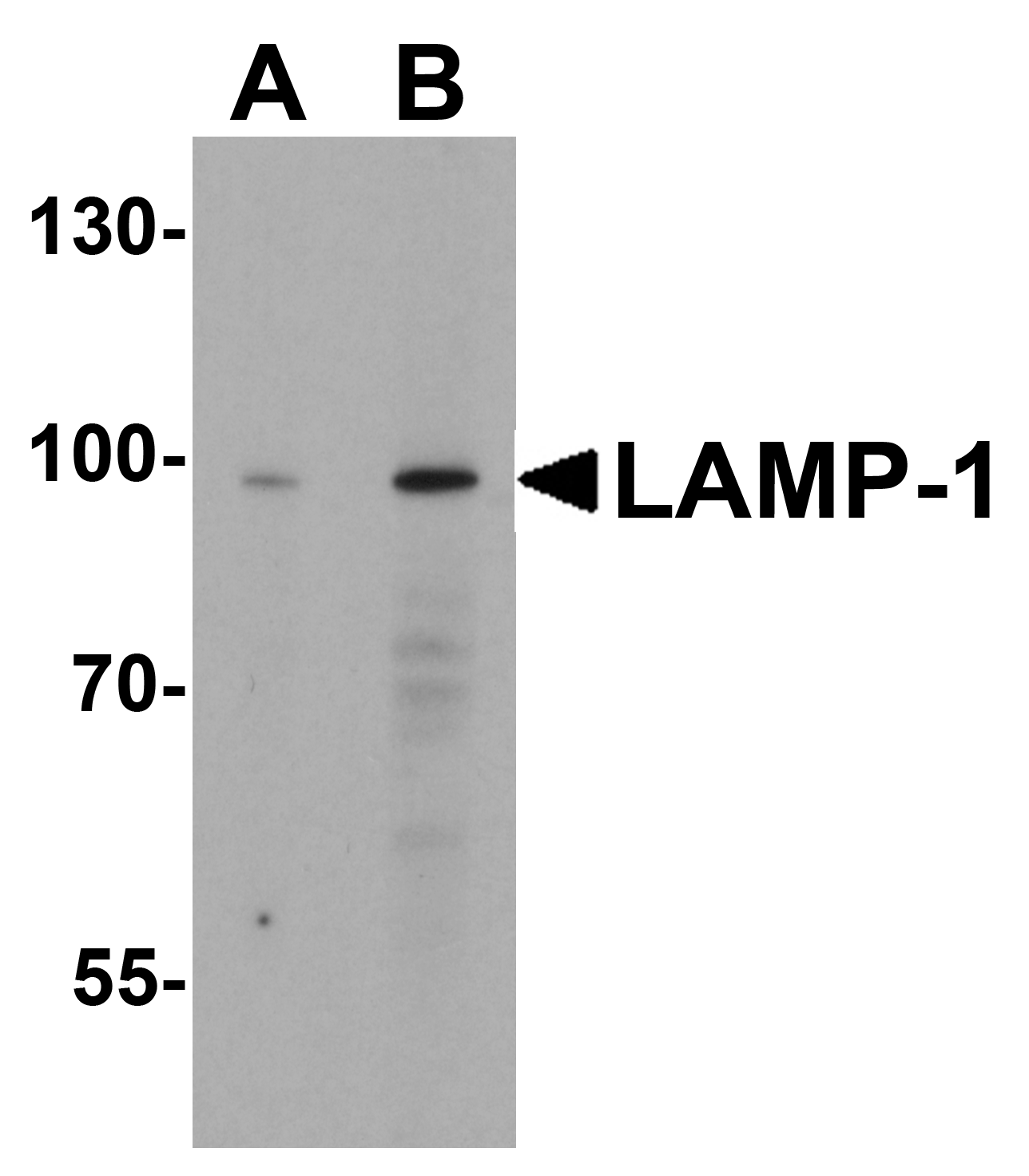 LAMP-1 Antibody