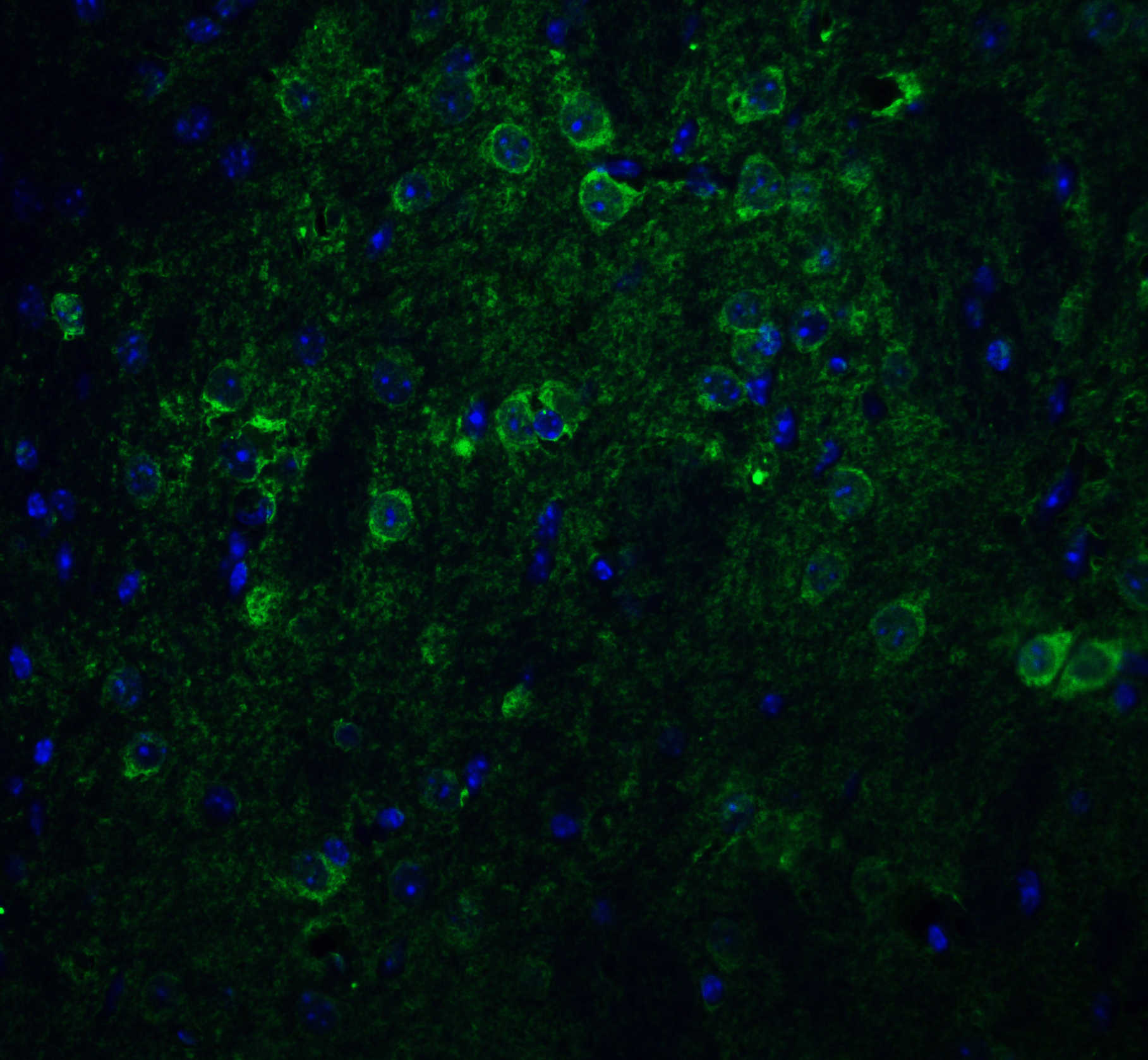 Nicastrin Antibody