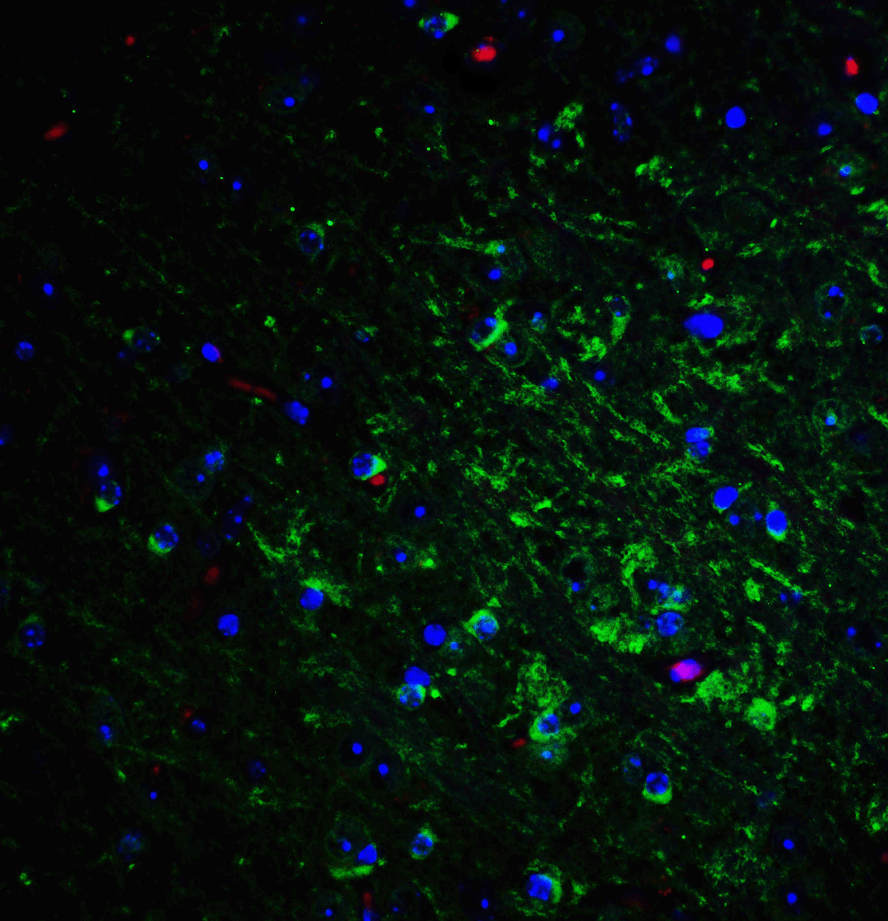 NogoA Antibody