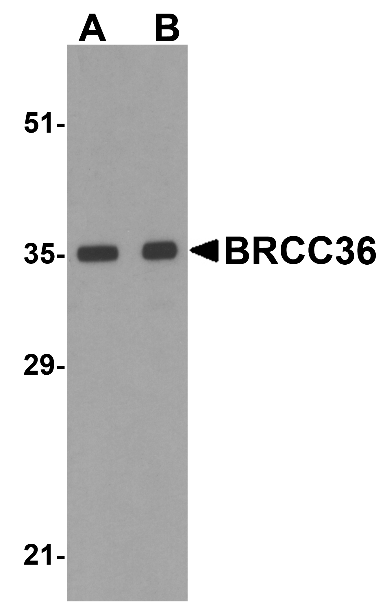 BRCC36 Antibody