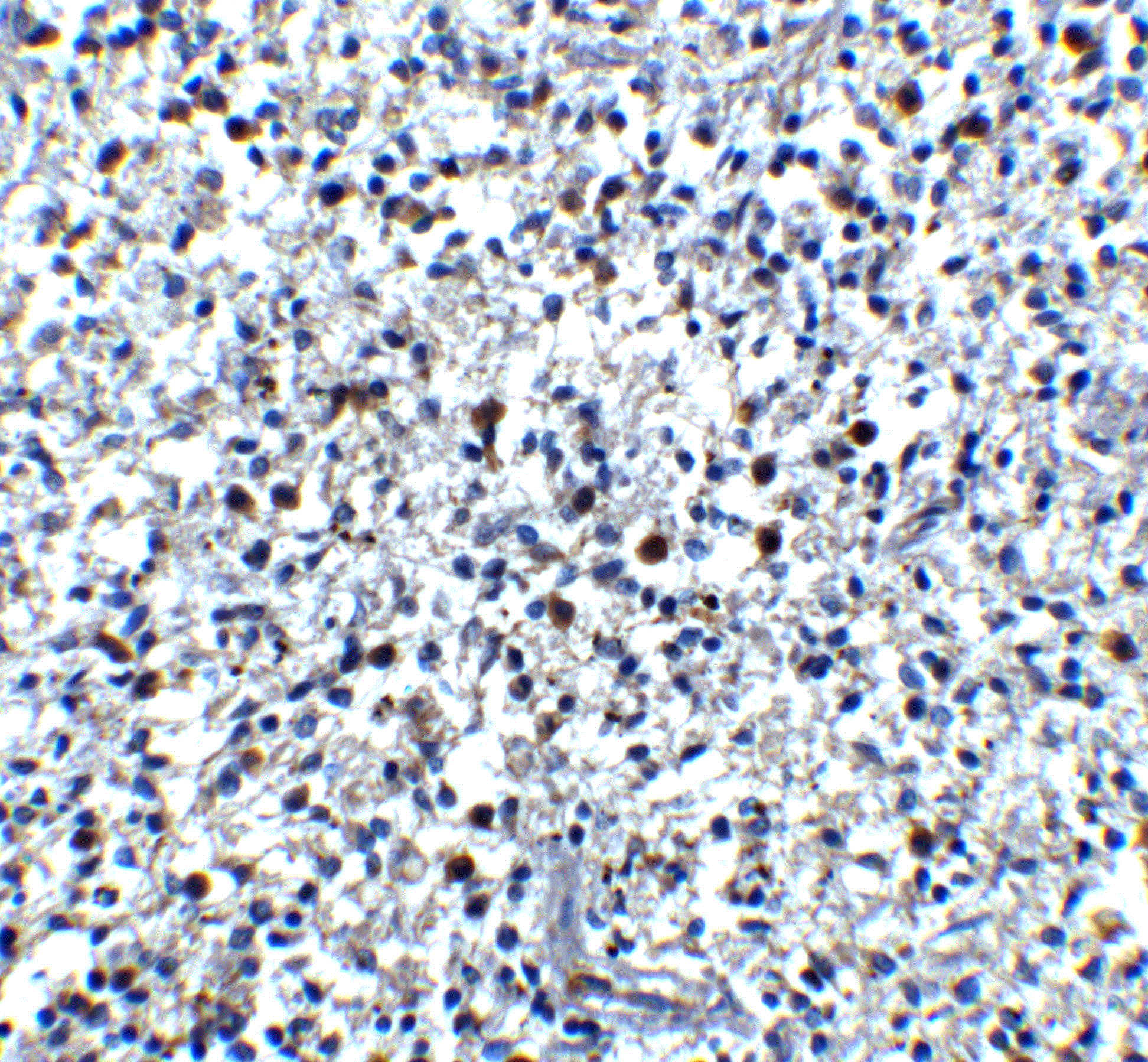 Cathelicidin Antibody