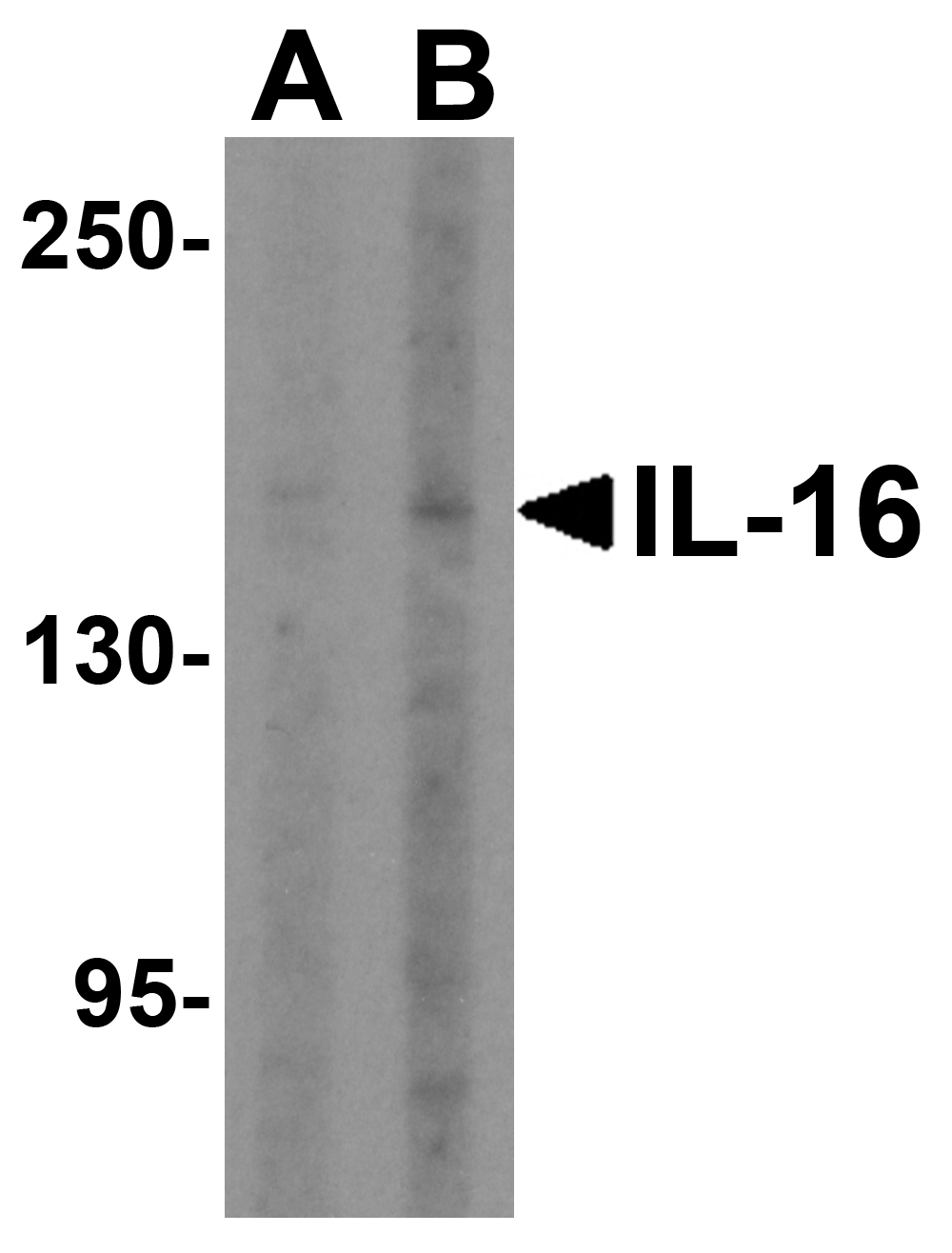 IL-16 Antibody