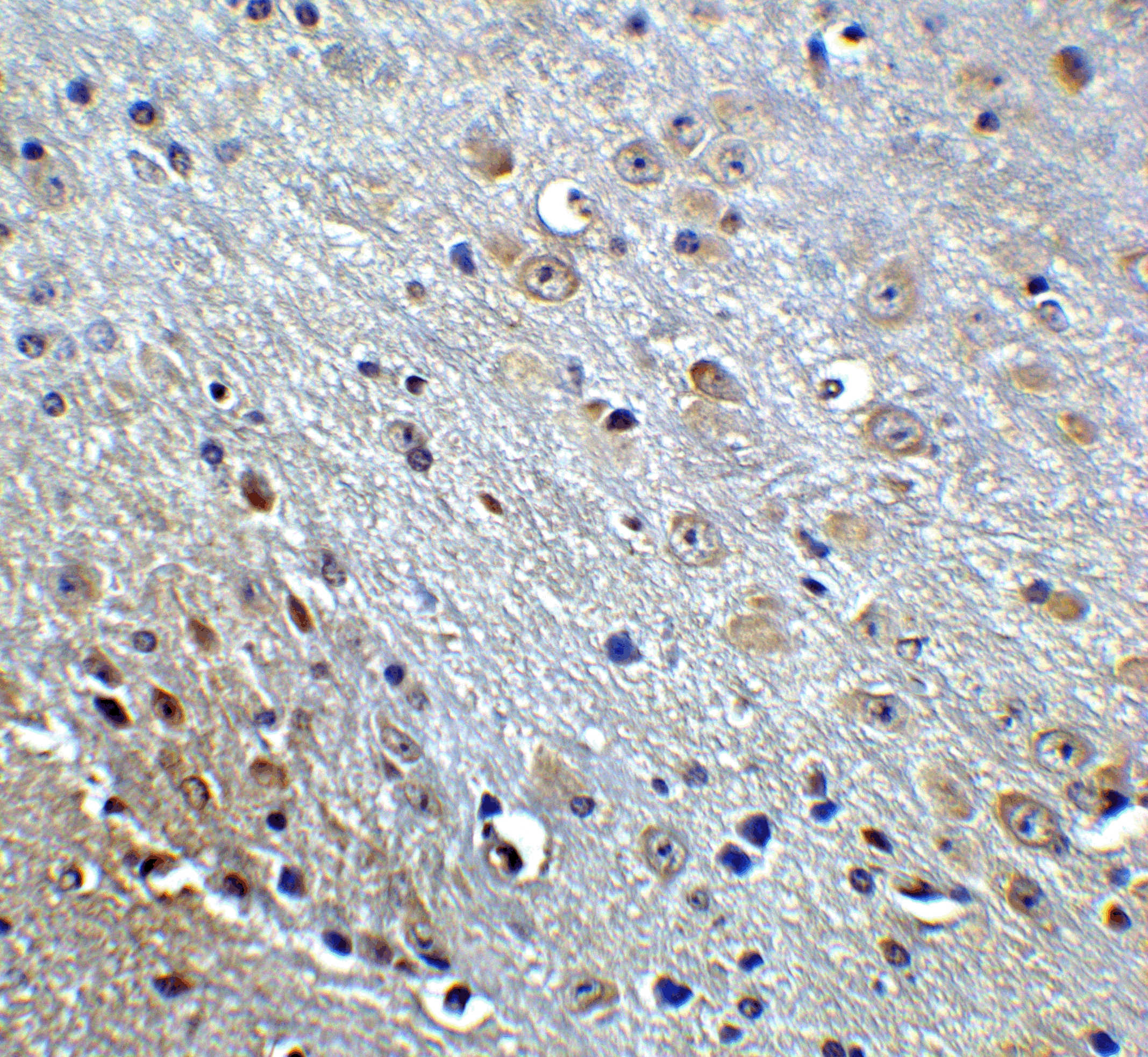 APP Antibody