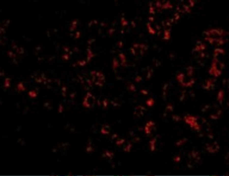 Albumin Antibody