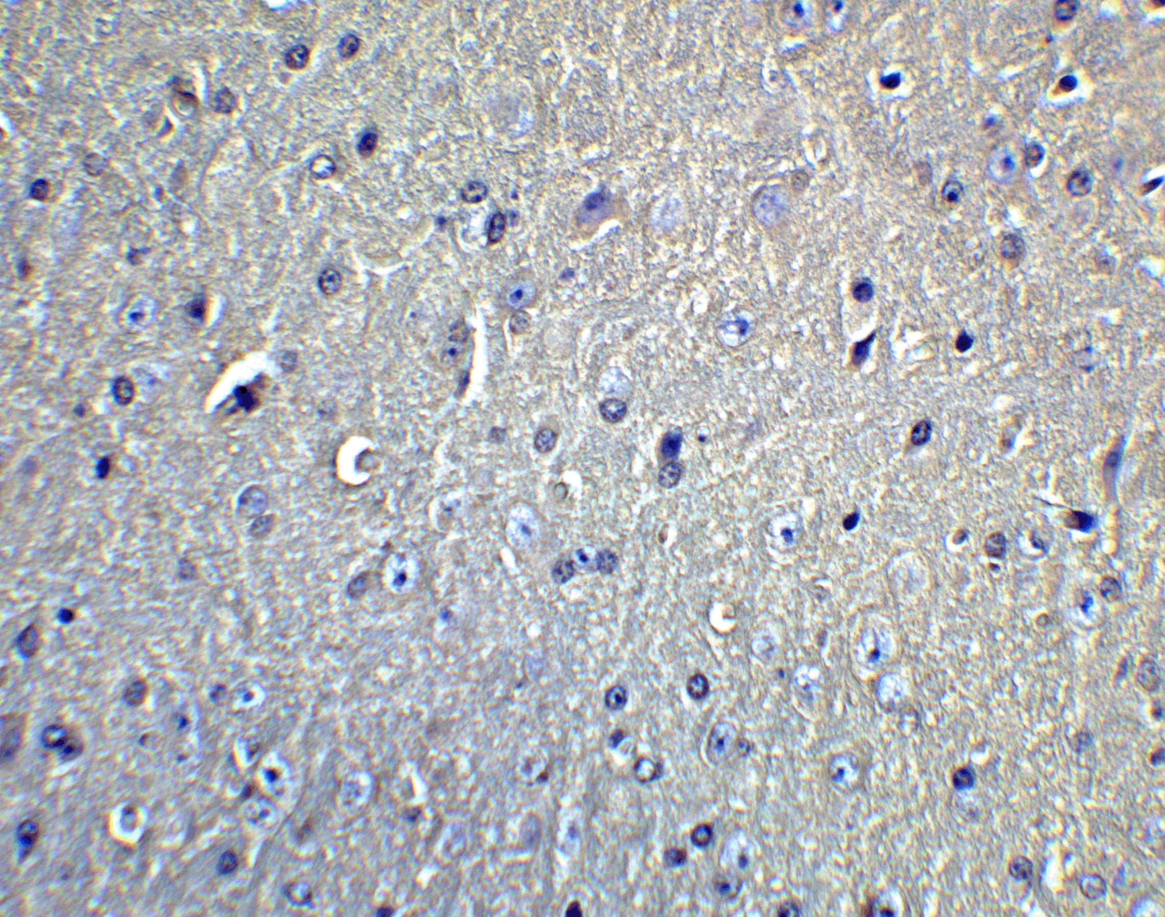 DCLK1 Antibody