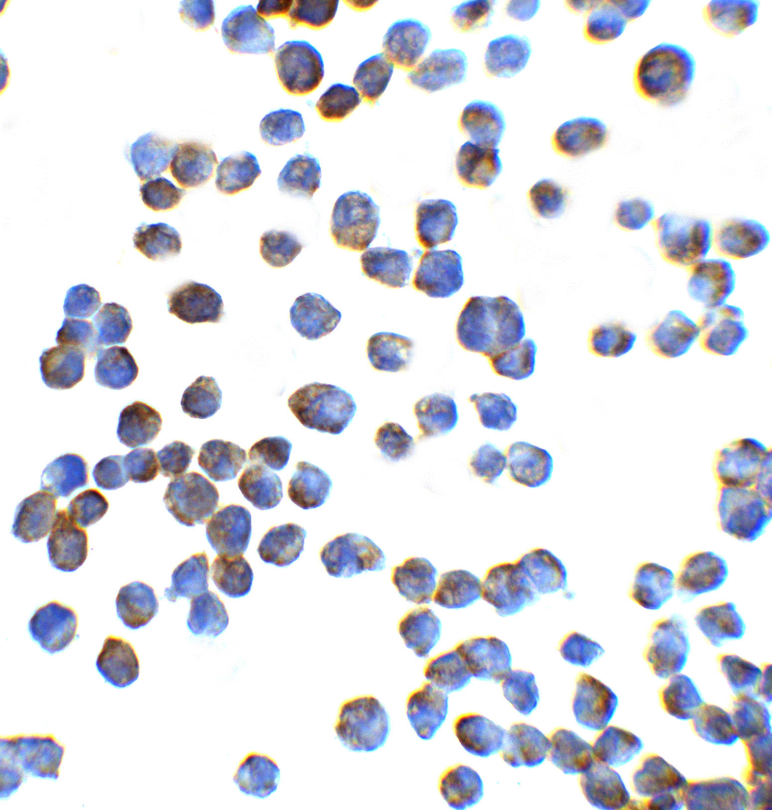 ZEB1 Antibody