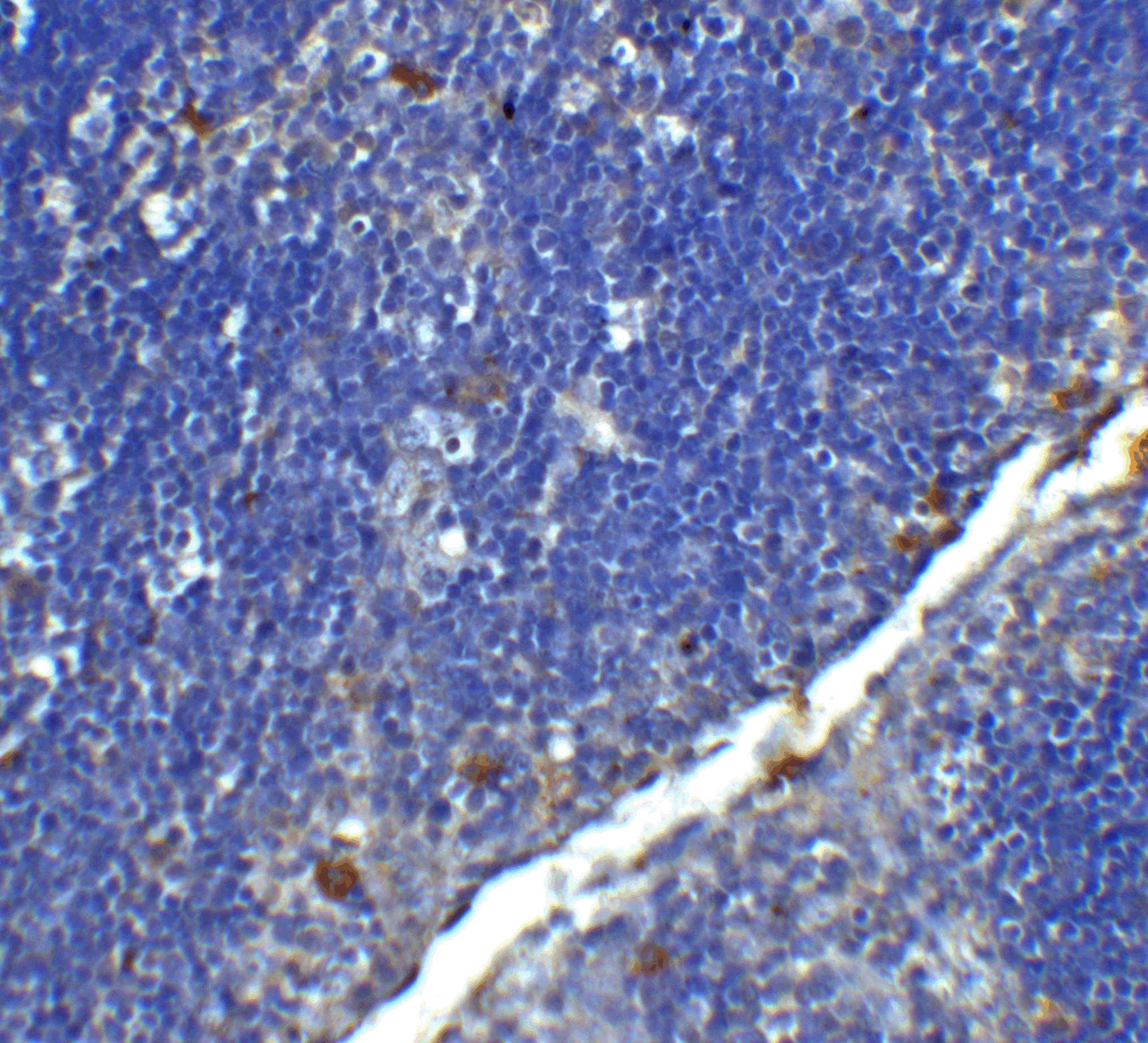 CD4 Monoclonal Antibody