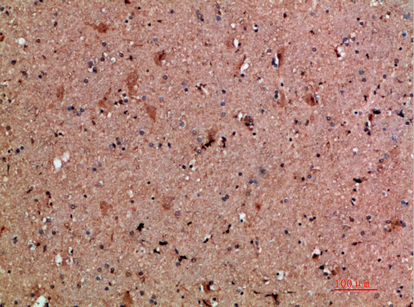 NNT-1/BSF-3 antibody