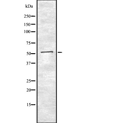 Angiotensin antibody