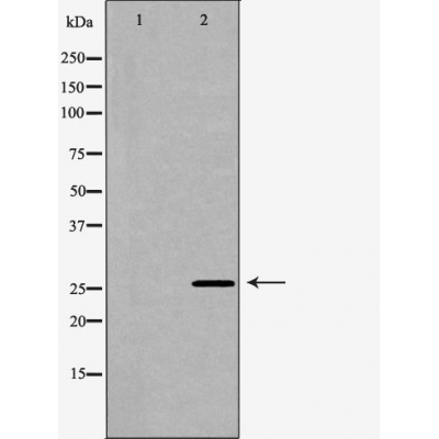 BCL2L1 antibody