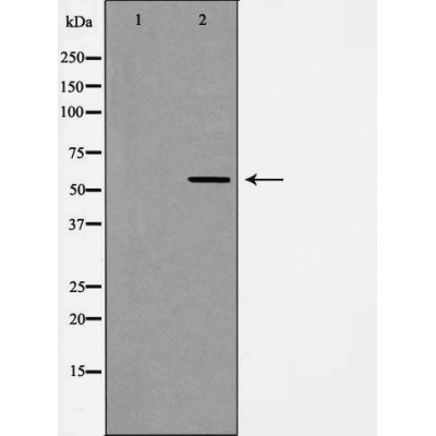 Angiopoietin 2 Antibody