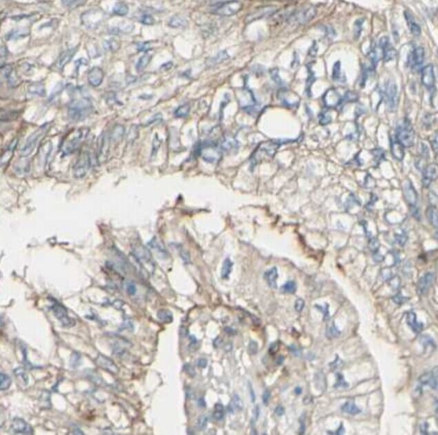 Angiopoietin 2 Antibody