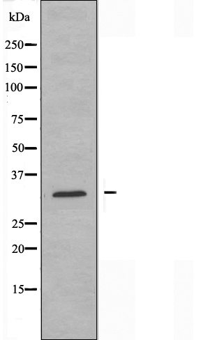 RPS4X antibody