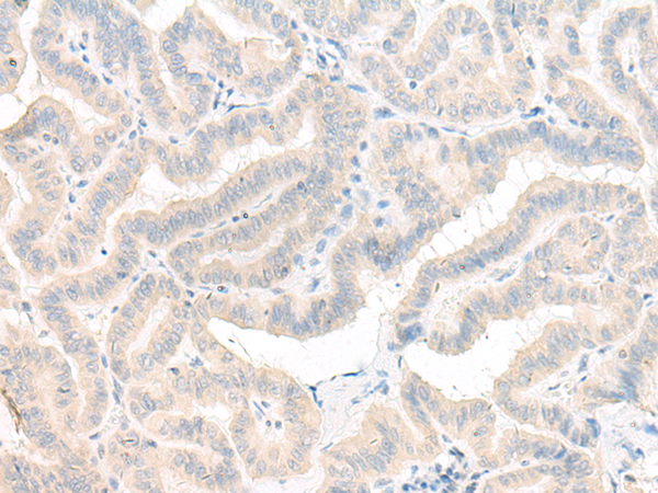 AOAH Antibody