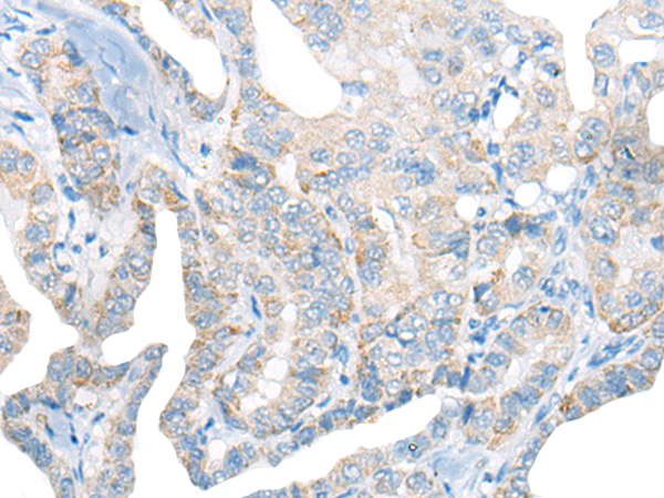CCL11 Antibody