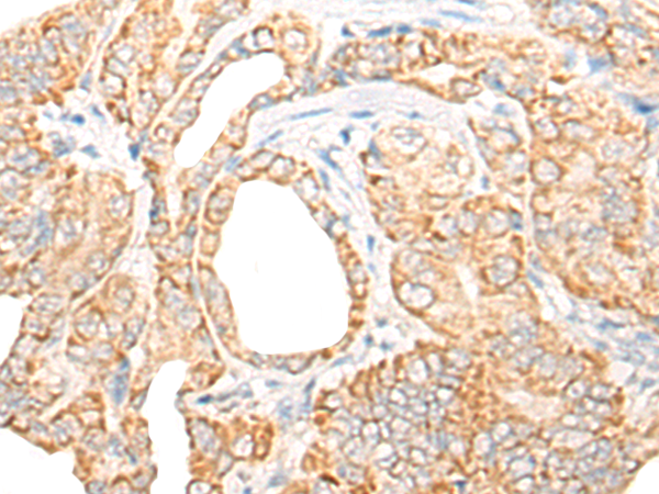 CORO7 Antibody