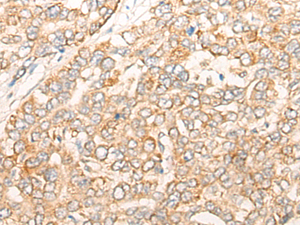 CORO7 Antibody