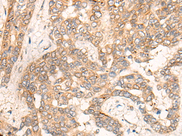 CPEB4 Antibody