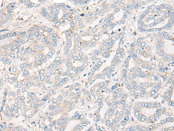 CPNE3 Antibody