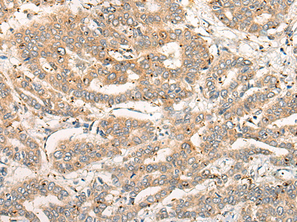 CPNE4 Antibody