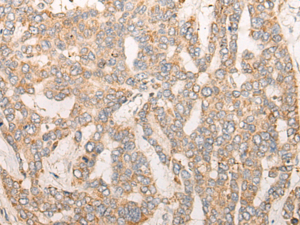 CPNE6 Antibody