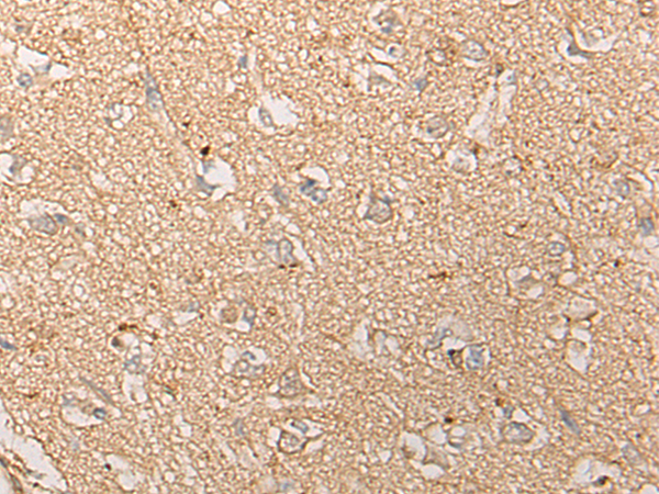 CPNE6 Antibody