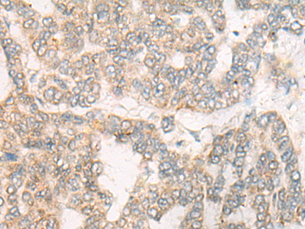CYFIP1 Antibody