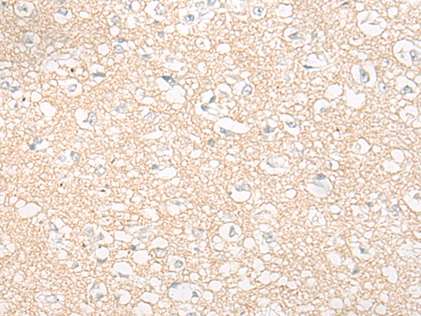 CYP2C8 Antibody