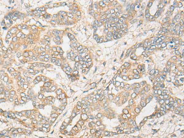 CYP3A5 Antibody