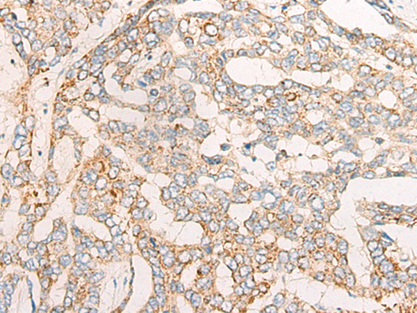 CYSLTR2 Antibody