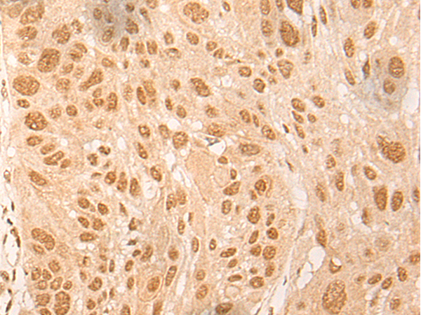 DBP Antibody