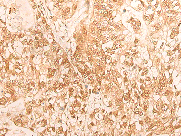 DBP Antibody