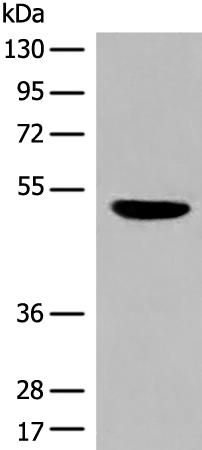 DBT Antibody