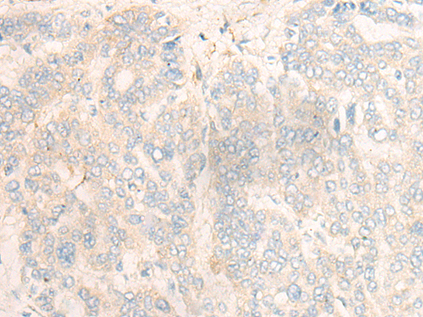 DBX1 Antibody