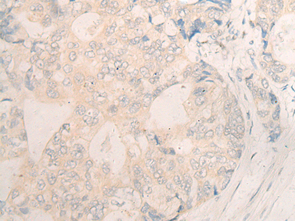 DBX1 Antibody