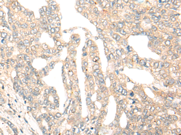 DCP2 Antibody