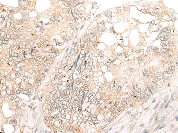 DCP2 Antibody