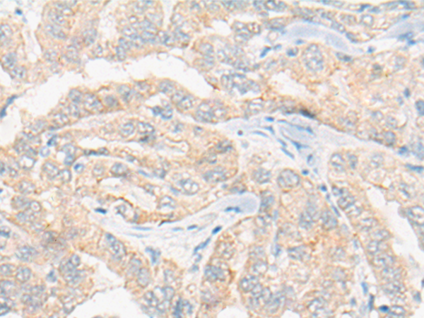 DDA1 Antibody