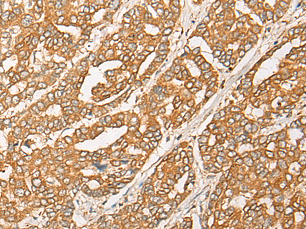 GNB1L Antibody