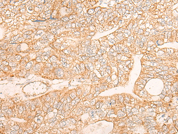 KRT9 Antibody