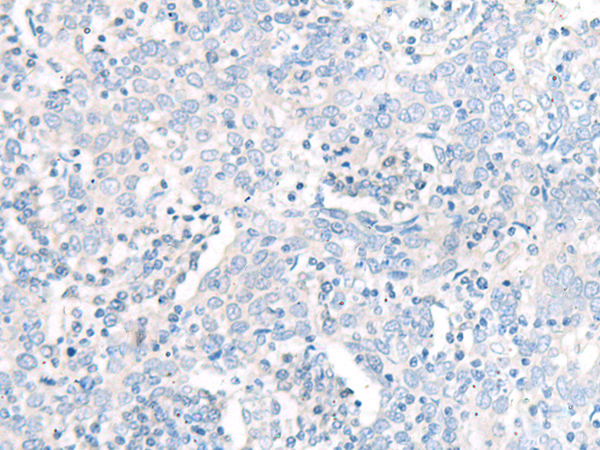 QARS Antibody