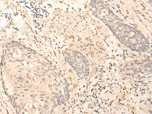 TADA3 Antibody