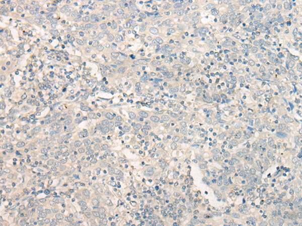 TAGAP Antibody