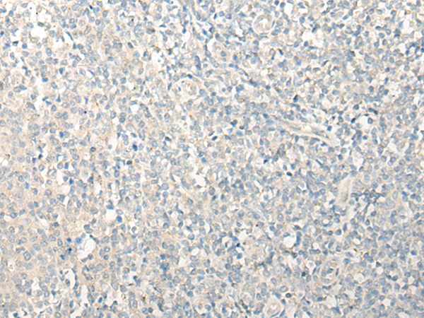 TAGAP Antibody