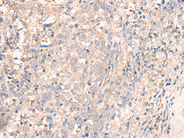 TMEM45A Antibody