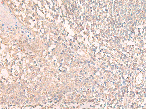 TMEM45A Antibody